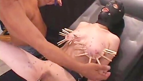 Cunt On Fire Bdsm Whore Electro Shockedd By Whacko Fucken Dr Prick!